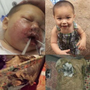 Toddler critically burned in Swat Raid Georgia